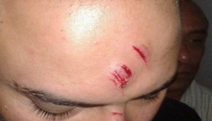 ضابط شرطة يعتدي علي محامي بمحكمة محرم بك