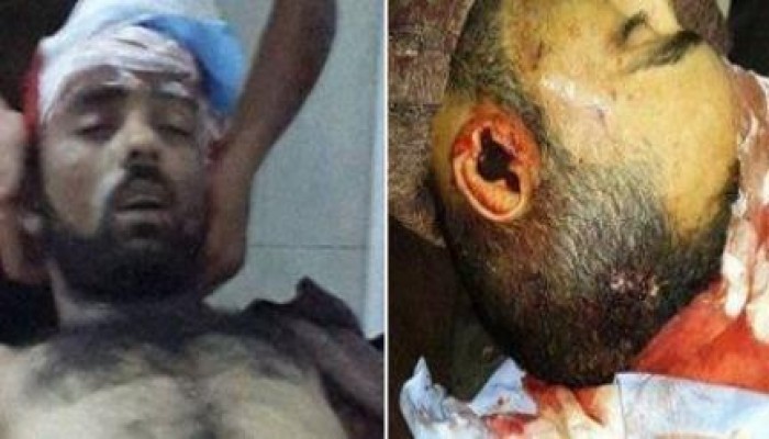 مقتل سائق وإصابة آخر برصاص أمين شرطة في مدينة"سمالوط"