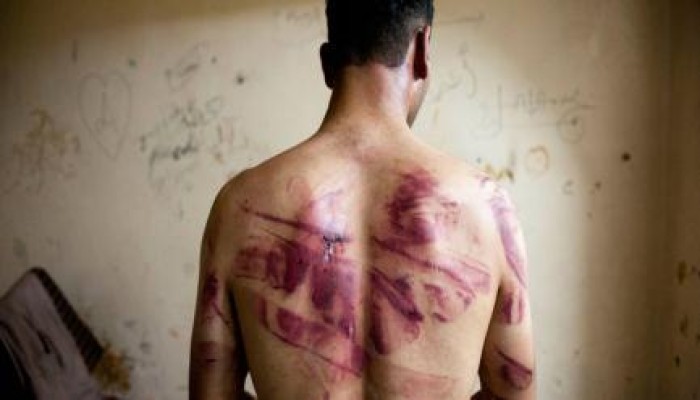 منظمات فلسطينية تقاضى "أبو مازن" دوليًّا بتهمة تعذيب وانتهاك آدمية المعتقلين