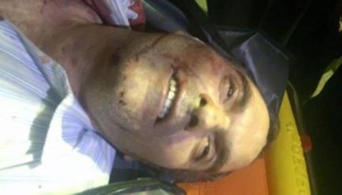 أطباء شرعيون: قيادات الإخوان التسعة تعرضوا للتعذيب قبل تصفيتهم