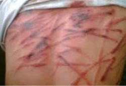 البحيرة: حفلات تعذيب مستمرة بحق معتقلي قسم شرطة "حوش عيسي"