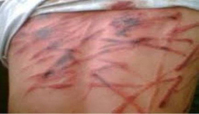 البحيرة: حفلات تعذيب مستمرة بحق معتقلي قسم شرطة "حوش عيسي"