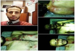 قضاء الانقلاب يأجل قضية "تعذيب محامي المطرية" إلى 15 أكتوبر للمرافعة
