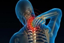 آلام العنق..طرق العلاج والوقاية