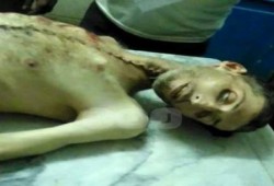 لحظات دفن "عماد حسن" شهيد اهمال الانقلاب الطبي بسجن العقرب (فيديو)