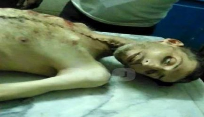 لحظات دفن "عماد حسن" شهيد اهمال الانقلاب الطبي بسجن العقرب (فيديو)