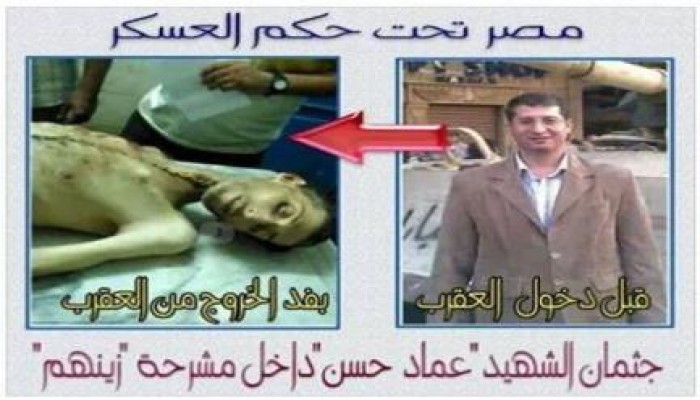 بعد القتل الطبي للشهيد عماد حسين.. حظر الأدوية "داخل العقرب"