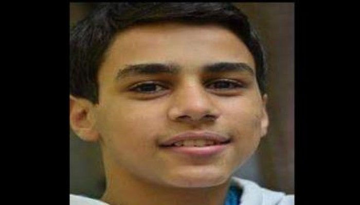 سجين جنائي يعتدي على شاب معتقل ويصيبه بجرح غائر في وجهه
