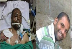 تجديد حبس “أحمد نصر” 45 يومًا بعد قبول طعن النيابة رغم تعذيبه وبتر قدميه