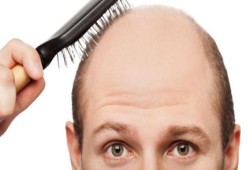 بالثوم وزيت الزيتون.. طريقة بسيطة لإعادة إنبات الشعر