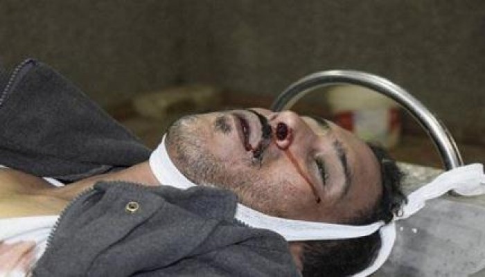 بالصور.. آثار التعذيب على جثة سجين قتلته شرطة الانقلاب بشبين القناطر