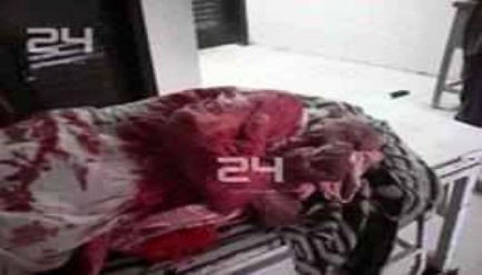 صور.. عسكر السيسي يقتلون مسنًّا 80 سنة بـ10 رصاصات