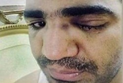 بلطجة الداخلية: ضابط يكسر أنف مواطن طلب التأكد من هويته