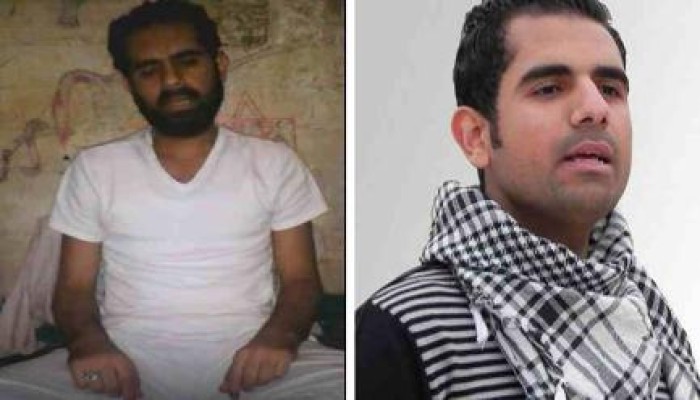 "اليماني" يدخل يومه 618 من إضرابه المفتوح عن الطعام