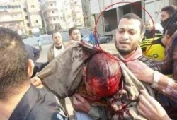 "الأطباء" تطالب بفتح تحقيق عاجل حول مقتل الطبيب محمد عوض