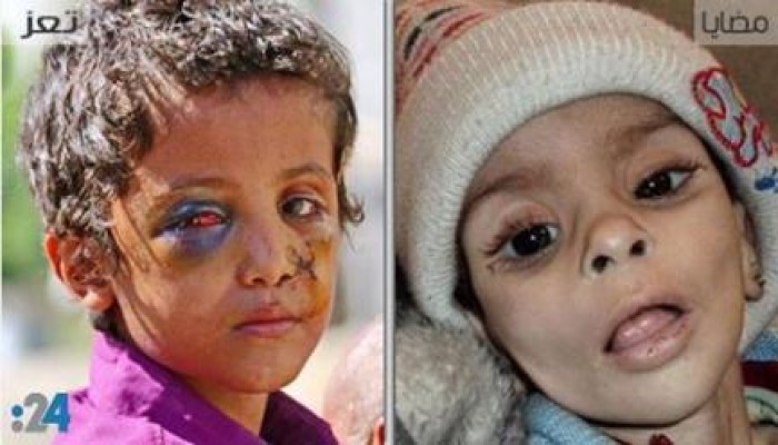 تعز ومضايا... نموذجان لسلاح تجويعي يحترفه حلفاء إيران
