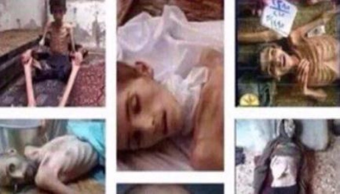 "الأمم المتحدة": 400 حالة بين الحياة والموت فى "مضايا" بسبب الحصار