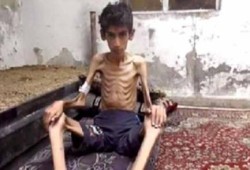 "مضايا" بسوريا .. كارثة لم يشهد لها العالم مثيل
