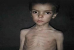 سوريا: الجوع يهدد الغوطة ومخاوف من موت المئات بمضايا