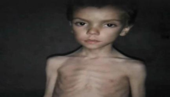 سوريا: الجوع يهدد الغوطة ومخاوف من موت المئات بمضايا