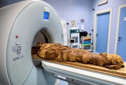 مستشفى إيطالي يستخدم الأشعة المقطعية لكشف أسرار مومياء مصرية