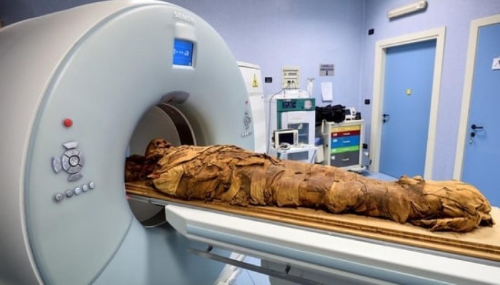 مستشفى إيطالي يستخدم الأشعة المقطعية لكشف أسرار مومياء مصرية