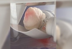ثورة في مجال الطب.. "قلب شبحي" قد ينقذ حياة الملايين
