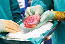 حكم زراعة الأعضاء..  جدل واسع أنكره الشعراوي وأجازه الأزهر والقرضاوي
