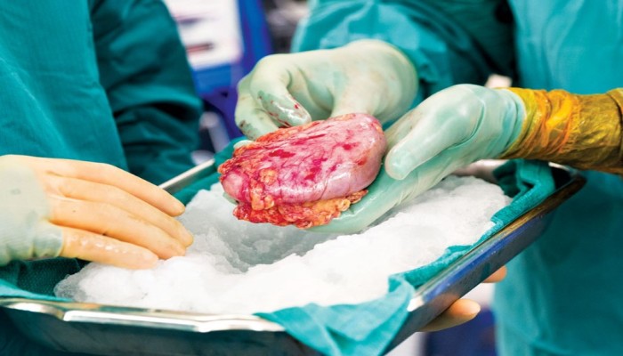 حكم زراعة الأعضاء..  جدل واسع أنكره الشعراوي وأجازه الأزهر والقرضاوي