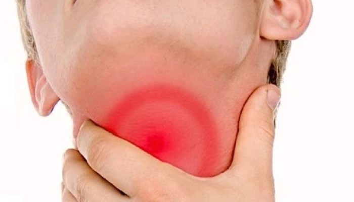 منها التهاب اللوزتين.. رائحة الفم الكريهة قد تدل على هذه الأمراض