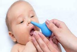 ٨ طرق طبيعية لعلاج إنسداد أنف الرضيع