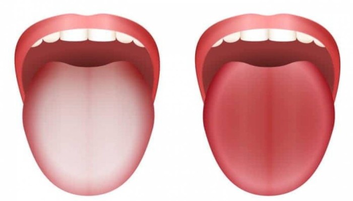 احذر هذين اللونين.. 10 ألوان للسان تشير إلى الخطر