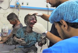 ملائكة تحت القصف.. أطفال غزة بين معاناة الحصار وتمزيق الصواريخ (تقرير)