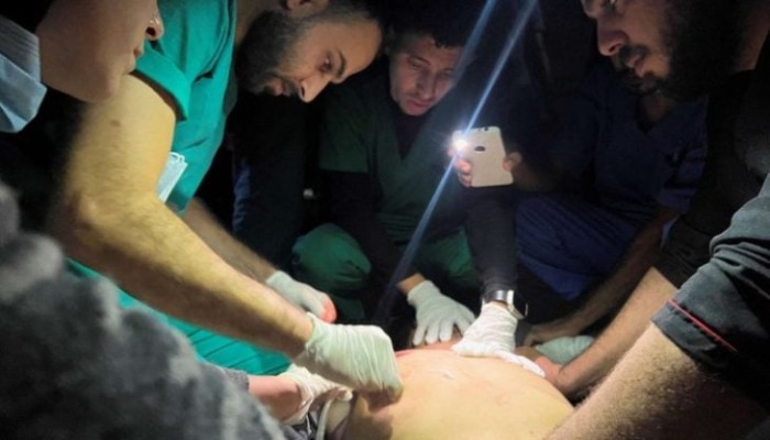ألف شهيد فلسطيني خلال 24 ساعة في القصف المتواصل على غزة