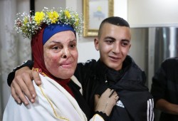 بجسد محترق وروح وثابة.. إسراء جعابيص: نخجل من الفرح وفلسطين جريحة.. بروفايل