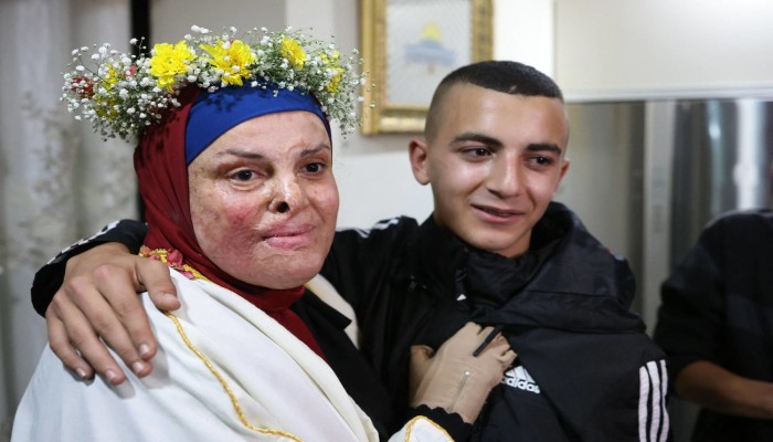 بجسد محترق وروح وثابة.. إسراء جعابيص: نخجل من الفرح وفلسطين جريحة.. بروفايل