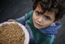 80% من أطفال غزة يعانون فقرا غذائيا حادا