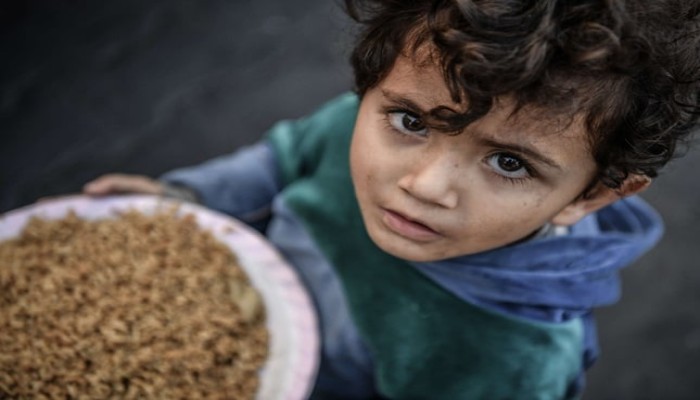 80% من أطفال غزة يعانون فقرا غذائيا حادا