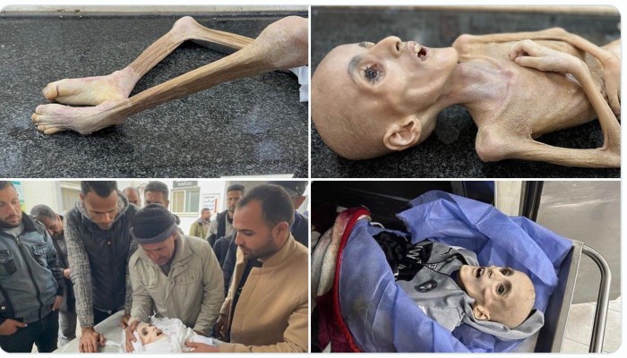الطفل الكفارنة.. يرحل “هيكلاً عظميًا” شاهدًا على “حرب التجويع والإبادة” في غزة