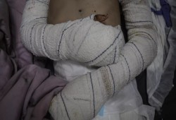أحد "الأيام الوحشية" في غزة