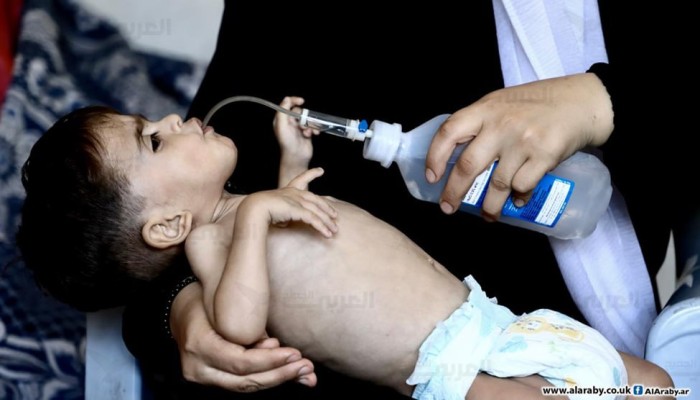صرخات الجوع... ندرة الغذاء في ذروتها شمالي قطاع غزة وجنوبه