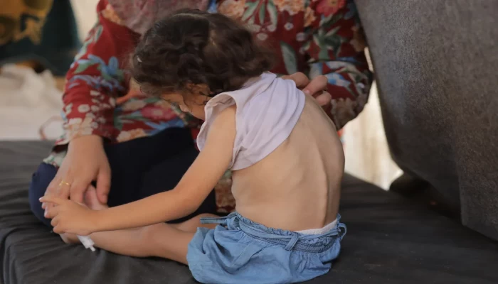 الفلسطينيون في غزة يكافحون لإطعام أطفالهم مع اقتراب المجاعة