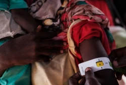 المرصد العالمي للجوع: السودان يواجه خطر المجاعة في 14 منطقة