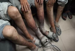 الأمم المتحدة تفصل استخدام إسرائيل للتعذيب والانتهاك الجنسي ضد الأسرى الفلسطينيين