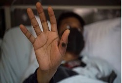 كابوس جديد يُرهق العالم.. "جدري القردة" حقيقة أم مؤامرة؟