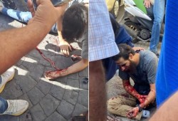 حزب الله استورد أجهزة الاتصالات المفجّرة قبل 5 أشهر