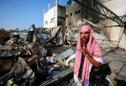 عائلة الفلسطيني المحترق تروي عواقب الهجوم الإسرائيلي