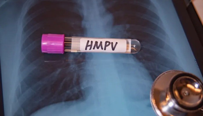 ما حقيقة انتشار الفيروس الرئوي  HMPV في مصر؟