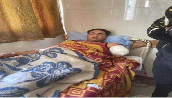 نمر طنطا التهم يد عامل في "45 ثانية".. أين معايير السلامة في عروض السيرك المصري؟