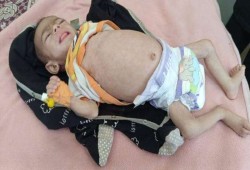 المجاعة تتفشى في غزة بمستويات كارثية.. واليونيسف يوثق ارتفاعًا حادًا في وفاة الأطفال
